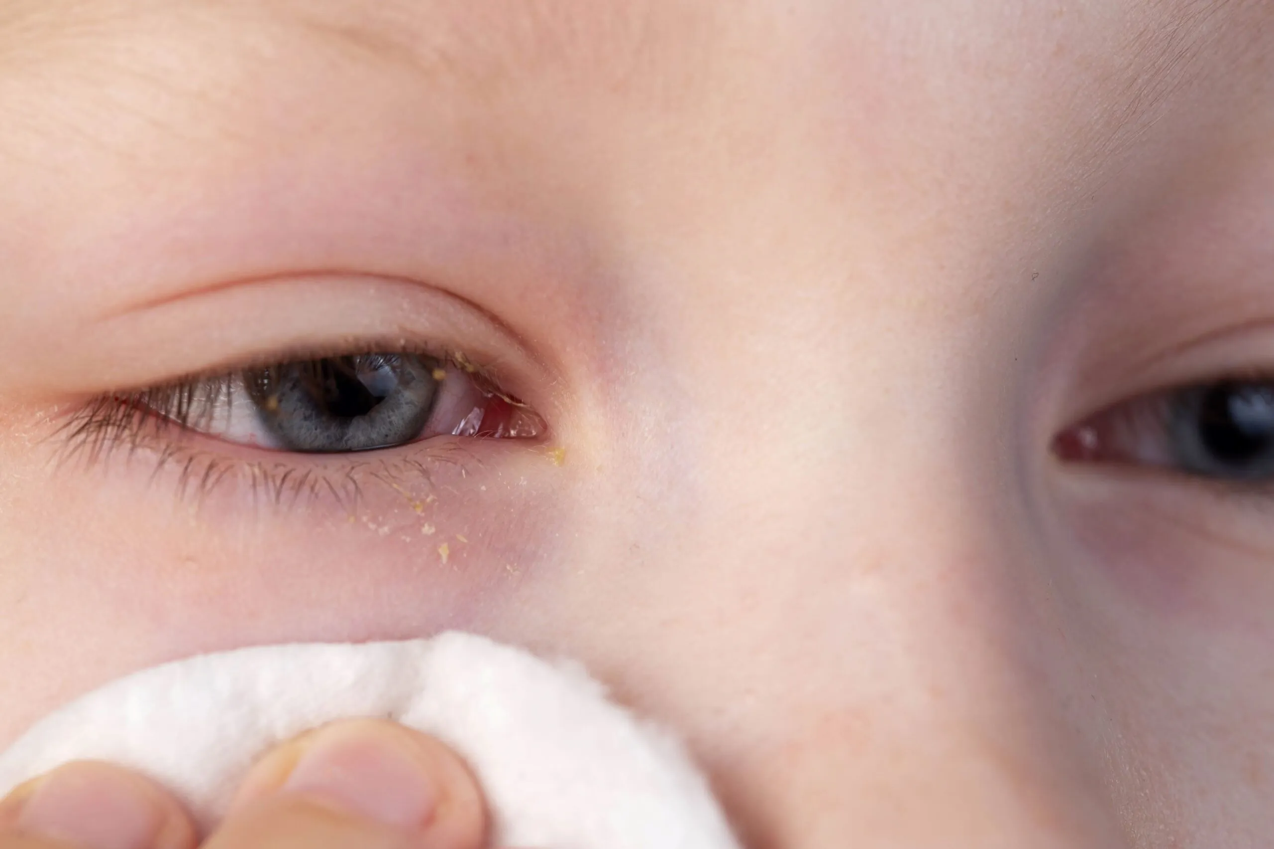 A woman using a cotton pad to clean her eyes