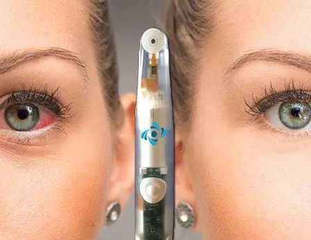 NuLids product in between two heads.